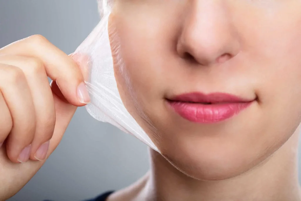 Coolpeel (Lazer peeling)