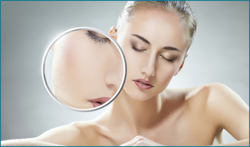 Coolpeel (Lazer peeling)